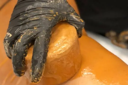 Cryotherapy body sculpting treatment